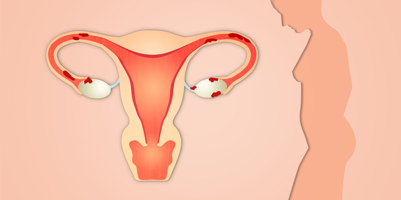 卵巢老化是什么原因造成的？这7种情况千万要小心，很多人中招了