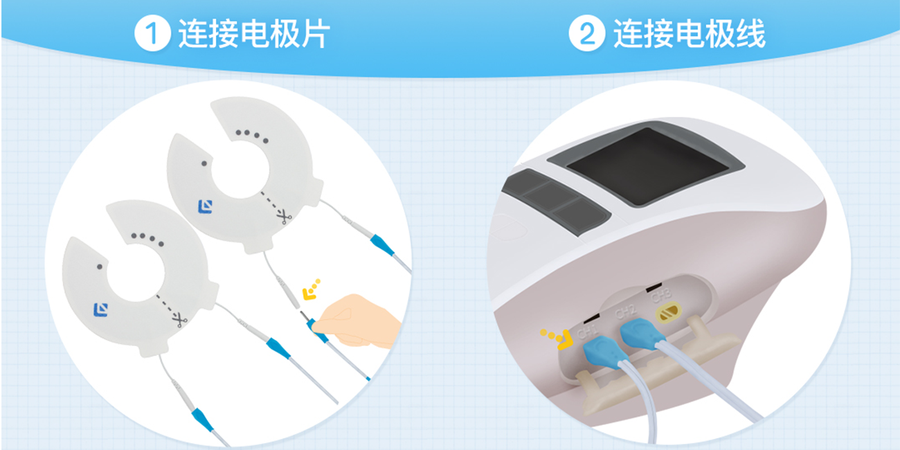 盆底肌修复仪器使用注意事项