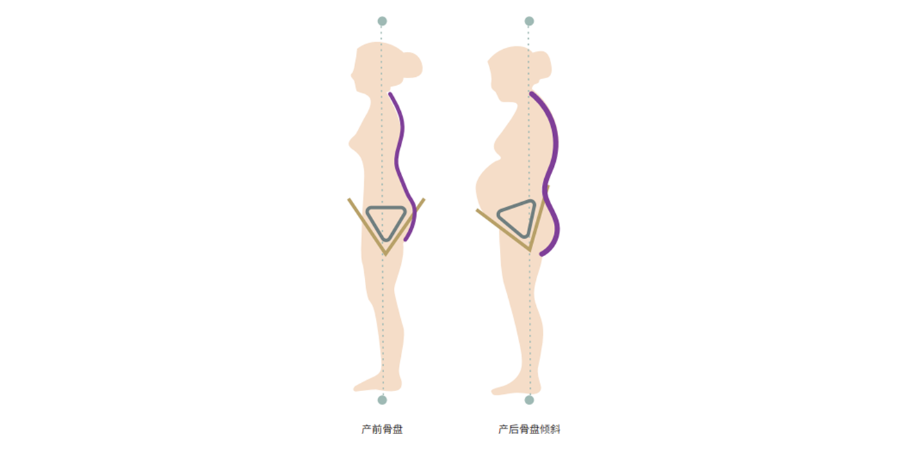 产后什么时候做骨盆修复最好？