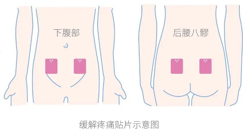电刺激能缓解痛经！这些月经问题，困扰上亿女性