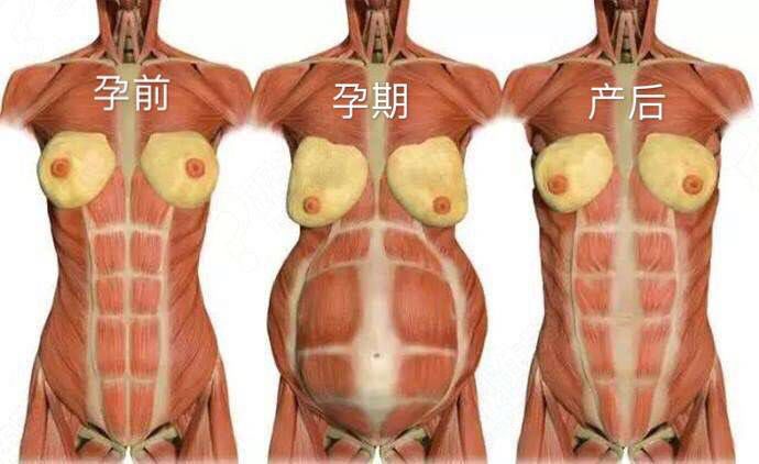 产后修复有哪些坑?(图2) 产后修复有哪些坑?(图2)