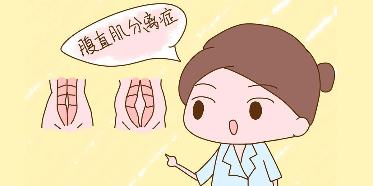 腹直肌分离如何纠正?(图2) 腹直肌分离如何纠正?(图2)
