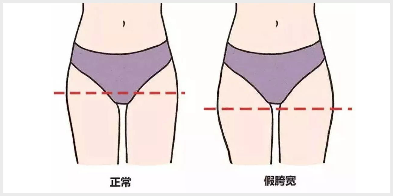 如何消除产后假胯宽? 记住这4招,健朗身姿向您招手(图1) 如何消除产后假胯宽? 记住这4招,健朗身姿向您招手(图1)
