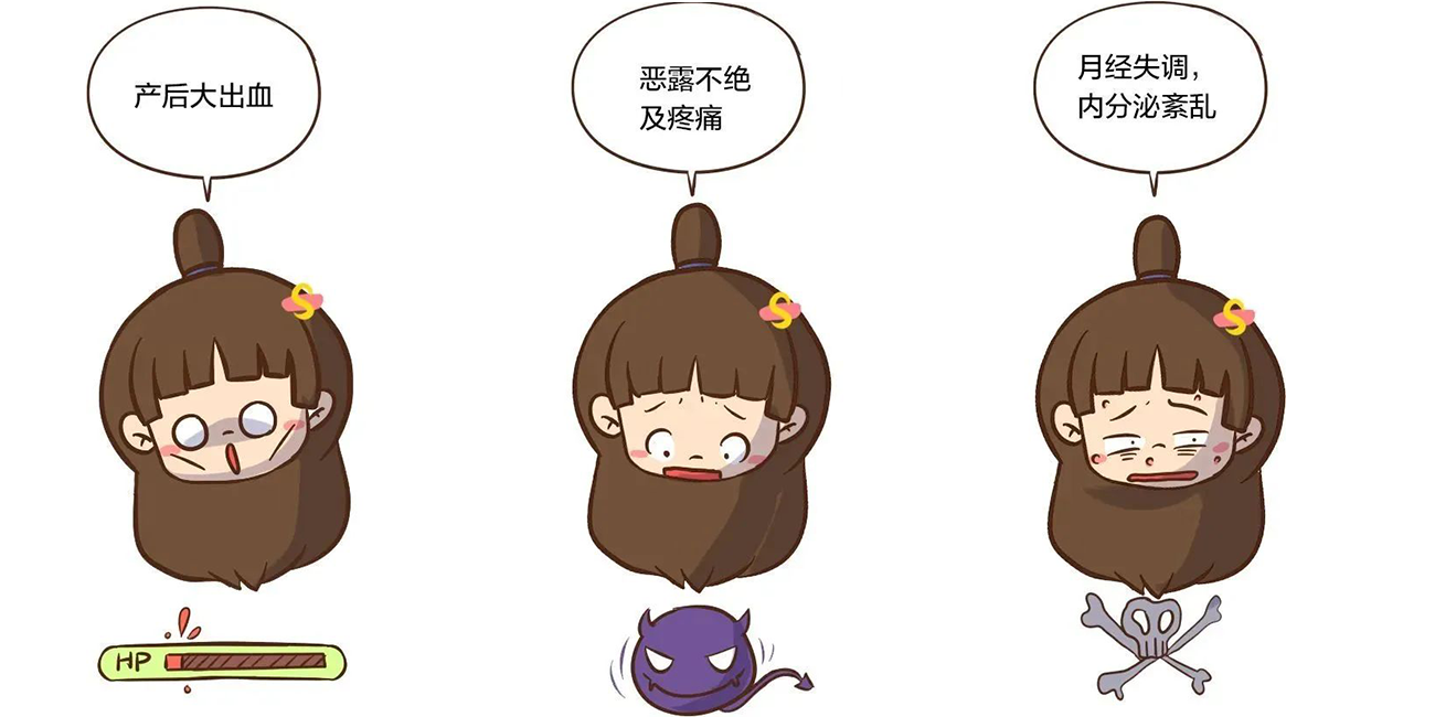 产后恢复的首要任务,子宫复旧 产后子宫恢复