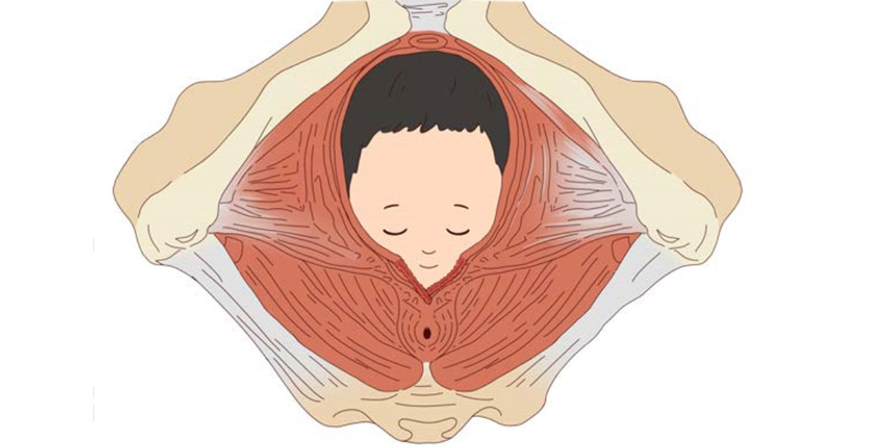 生完孩子为什么会出现子宫脱垂？主要是这6点造成的，务必小心(图3)