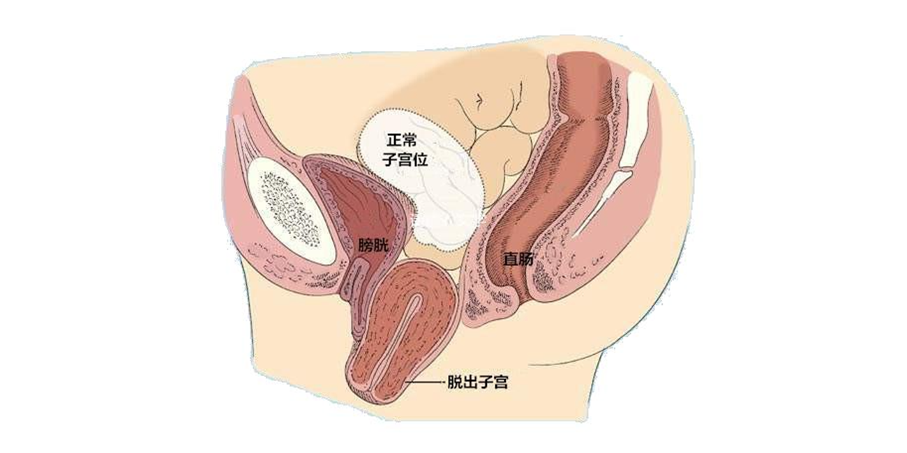 女性经常小腹疼痛?小心是这些因素在作怪(图2) 女性经常小腹疼痛?小心是这些因素在作怪(图2)